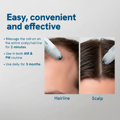 RootRise™ - 5X Growth Accelerator Serum By Zellavia