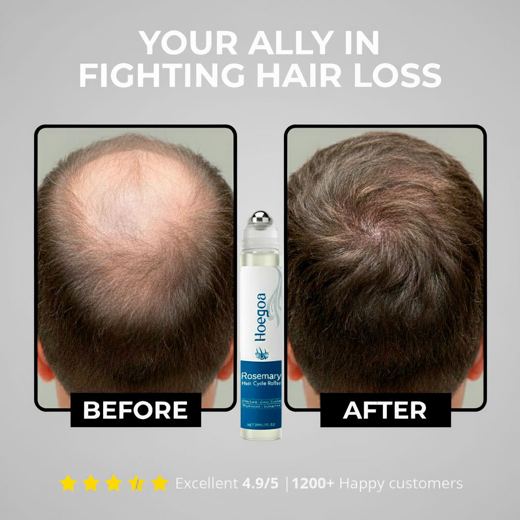 RootRise™ - 5X Growth Accelerator Serum By Zellavia