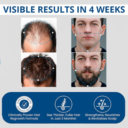 RootRise™ - 5X Growth Accelerator Serum By Zellavia