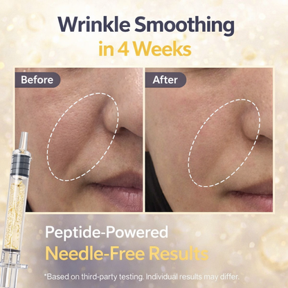 NEUROPEPTA™ - Injection-Inspired Peptide Ampoule by Zellavia